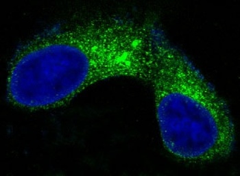 CEA CEACAM5 Rabbit Monoclonal Antibody