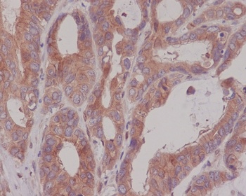CEA CEACAM5 Rabbit Monoclonal Antibody