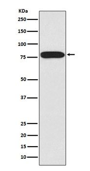 IRAK IRAK1 Rabbit Monoclonal Antibody