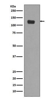 Integrin alpha 6 ITGA6 Rabbit Monoclonal Antibody