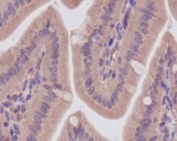 CaMKII CAMK2B Rabbit Monoclonal Antibody