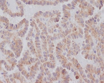 KIFC1 Rabbit Monoclonal Antibody