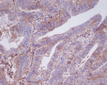 5T4 TPBG Rabbit Monoclonal Antibody