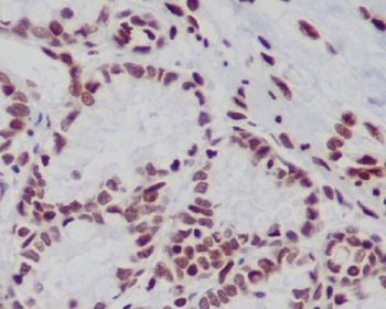 Histone H3 HIST1H3A Rabbit Monoclonal Antibody
