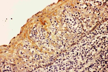 Caspase-8/CASP8 Rabbit Polyclonal Antibody