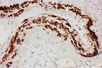 TFPI Rabbit Polyclonal Antibody