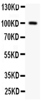 Prothrombin/F2 Rabbit Polyclonal Antibody