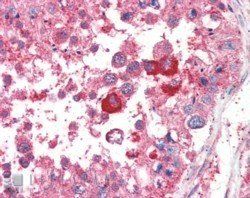 B5 Receptor/PCID1/EIF3M Antibody