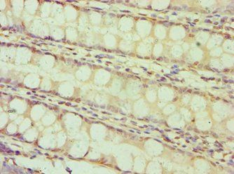 BAMBI Antibody