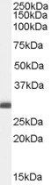 BCAP31/BAP31 Antibody