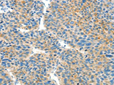 BCAT1 Antibody