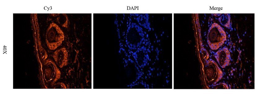 BCKDHA Rabbit Polyclonal Antibody
