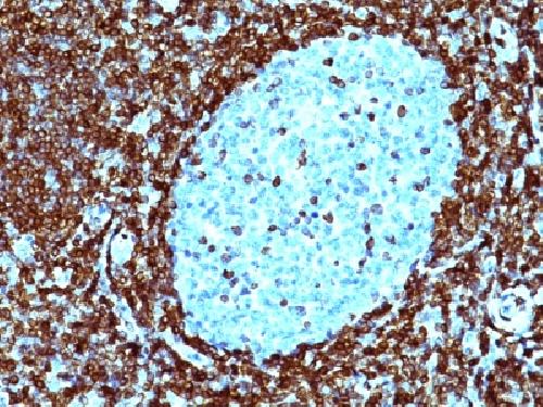 BCL2 Antibody