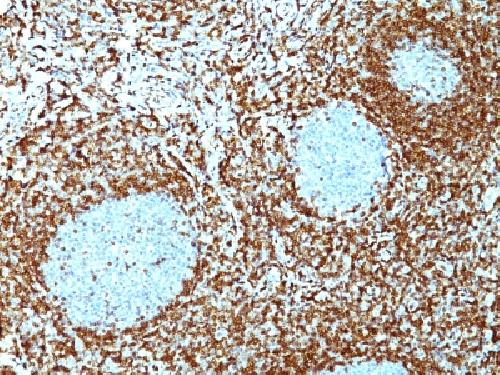 BCL2 Antibody