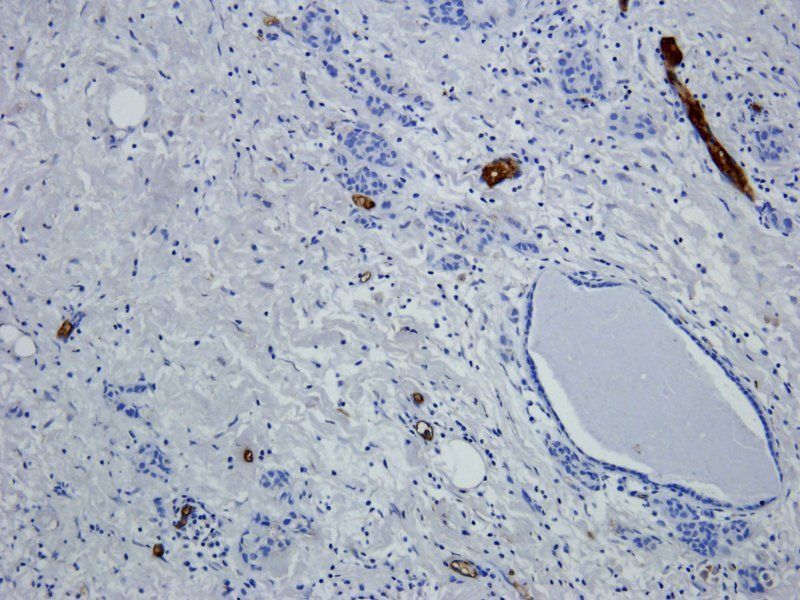 BCL2 Rabbit Polyclonal Antibody