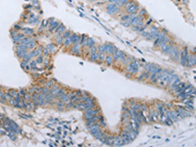 BDNF Antibody