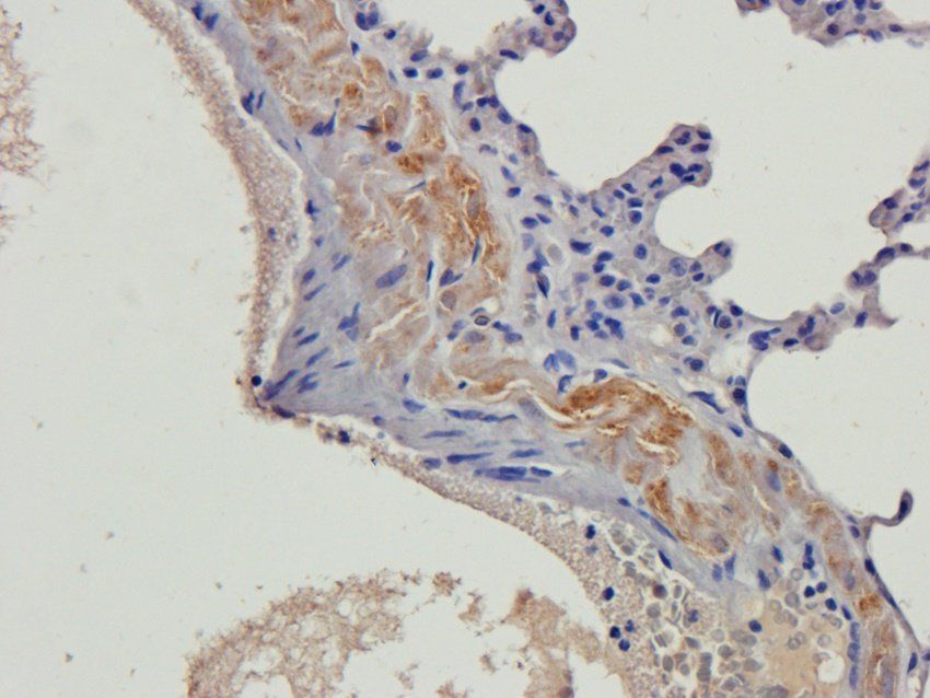 beta 2 Defensin Rabbit Polyclonal Antibody