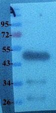 beta Actin Rabbit Polyclonal Antibody