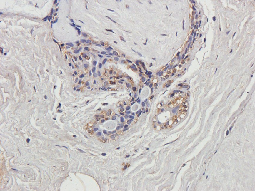 BMI1 Rabbit Polyclonal Antibody