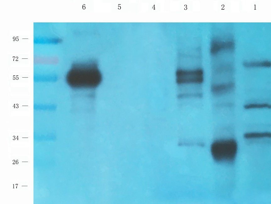 BMI1 Rabbit Polyclonal Antibody