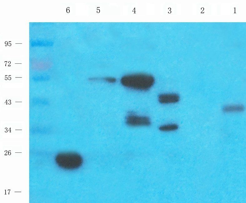 BMP11 Rabbit Polyclonal Antibody