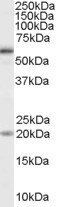 BMPR1A Antibody