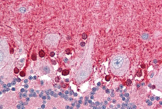 BPOZ/ABTB1 Antibody