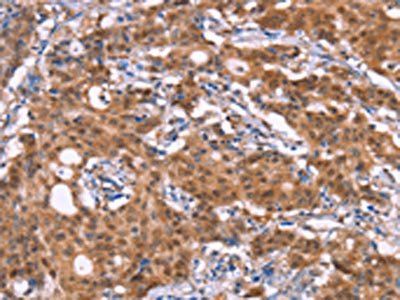 BRK1 Antibody