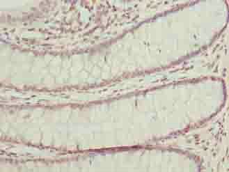 BUD31 Antibody