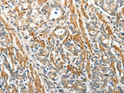 SELE Antibody