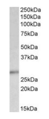 P27KIP1/CDKN1B (C Terminus) Antibody