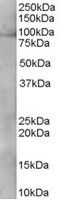 XAB2/HCNP Antibody