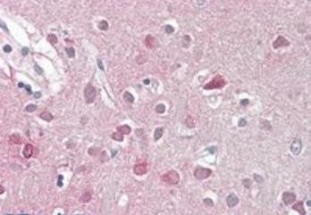 ORC3L Antibody