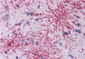 BAIAP2 (isoform 1) Antibody
