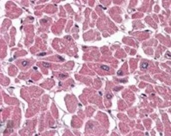 BPOZ/ABTB1 Antibody