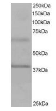 BPOZ/ABTB1 Antibody