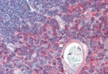 TXK Antibody
