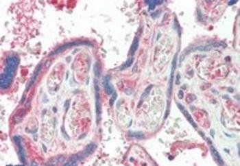 TXK Antibody