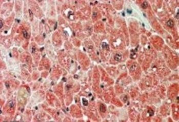 PPP2R5A Antibody