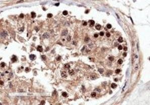 RACGAP1/MgcRacGAP Antibody