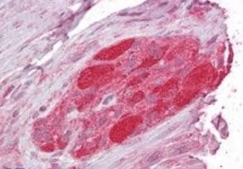 STUB1/CHIP Antibody