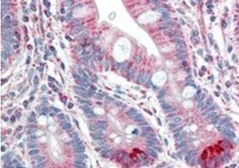 Spinesin/TMPRSS5 Antibody