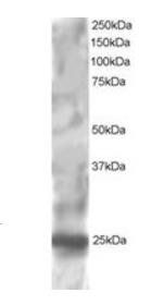 RGS1/1R20 Antibody