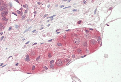 KLF8/BKLF3 Antibody