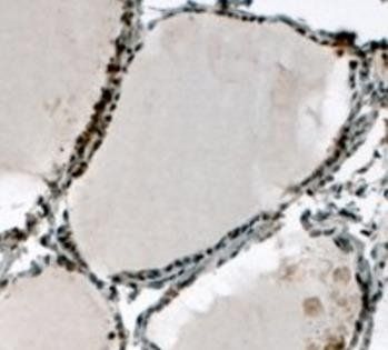 ELF5 Antibody