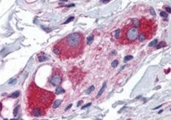 Goat anti-GTRAP3-18 / JWA Antibody