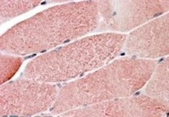Goat anti-GNIP / TRIM7 Antibody