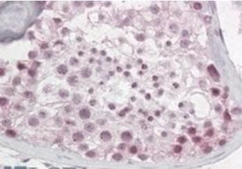 Pescadillo Antibody