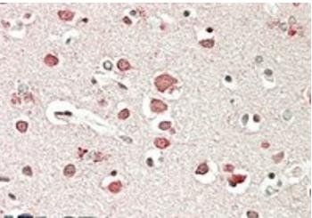 Neurobeachin Antibody
