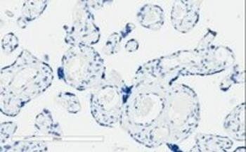PIK3C2A Antibody